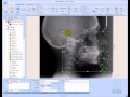 Ax.CEPH Cephalometric Analysis