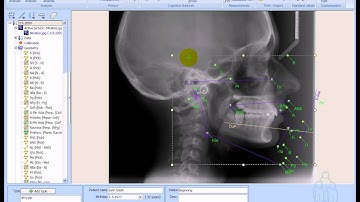 Ax.CEPH Cephalometric Analysis