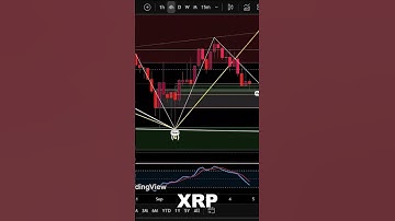 #XRP Inverse Head & Shoulders Pattern! 😮