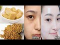 7 Days Skin Whitening Challenge with Fenugreek Ice Cubes to get Flawless, Spotless and Radiant Skin