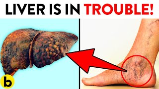 9 Ways Your Feet Are Telling You That Your Liver Is In Trouble