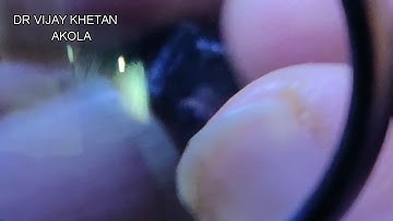 Removing infra-red filter from mobile phone camera. PART 1