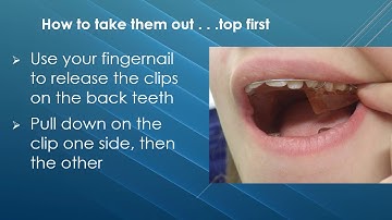 Twin Block advice and instructions