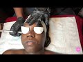 STEP BY STEP MICRODERMABRASION FACIAL DONE BY CROWNLUX_