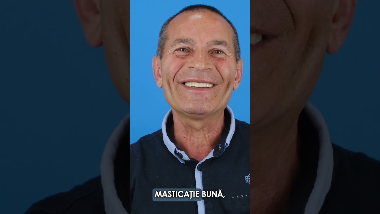 Lipsa de Dinti pe Arcada Superioara - Transformă-ți zâmbetul acum!