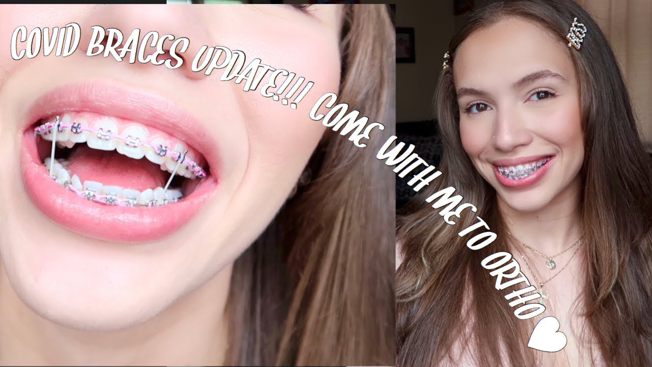 FIRST BRACES UPDATE AFTER QUARANTINE?! BIG CHANGES *OUCH*