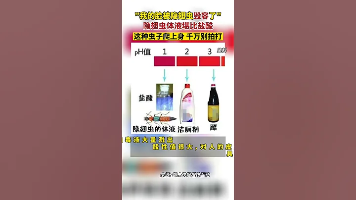 「我的臉被 隱翅蟲毀容了」！隱翅蟲每年夏天都有，其體液   比鹽酸，遇到它，千萬別拍打，用嘴吹走即可。 科普 生活小知識 - 天天要聞