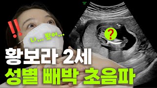 황보라 임신 16주 초음파 검사, 아들 or 딸｜오덕이 엄마 EP.10