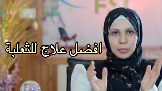 الثعلبة عند الأطفال - اسبابها و علاجها و الوقاية منها . د / هبة الله منصور .