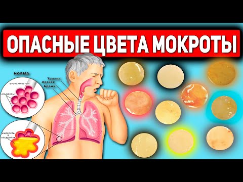 Видео: Когда мокрота коричневая?