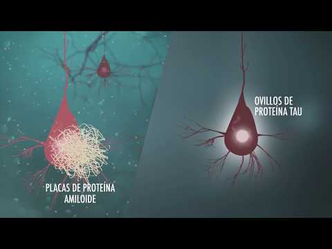 Video: Depósitos De Proteínas En El Hígado (amiloidosis) En Perros