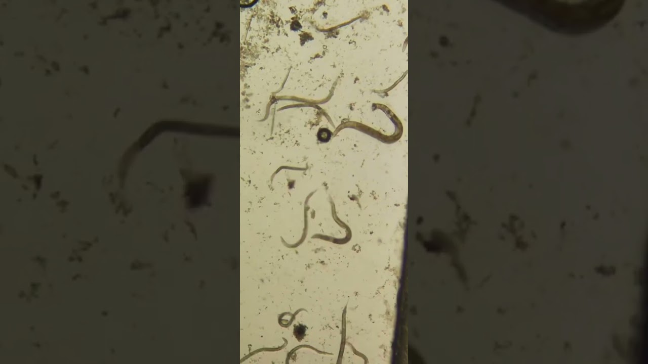 Глисты/ Кушаем побольше чеснока/ Чем очистить организм от глистов/ Руки мыть, надо чаще!/ 회충