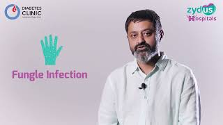 World Diabetes Day | Zydus Hospitals