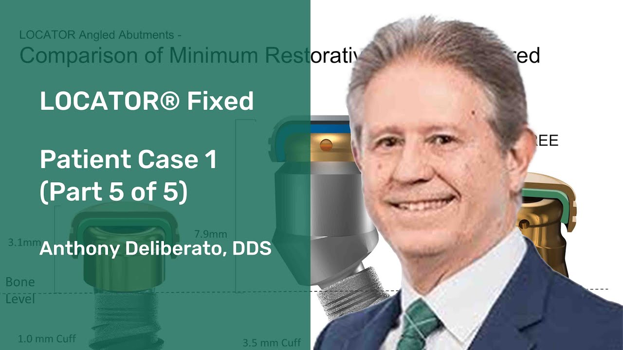 LOCATOR® Fixed: Patient Case 1 (Part 5 of 5)