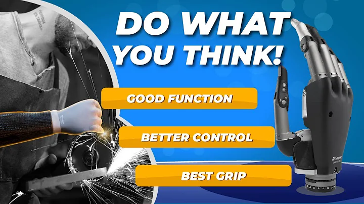 💁 Learn how upper limb prosthetics can help you gain your freedom!