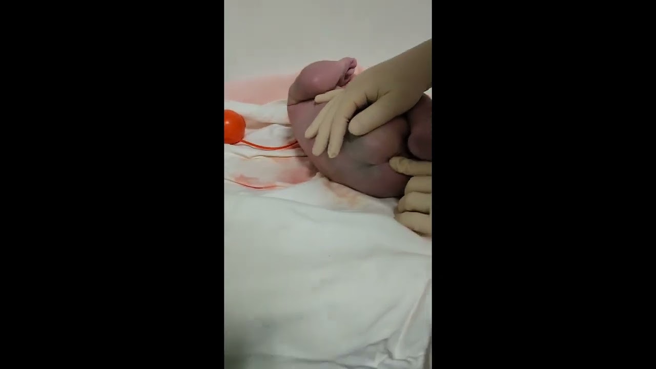 20221218_3 튼씩이 출산  신체 검사 이상무!