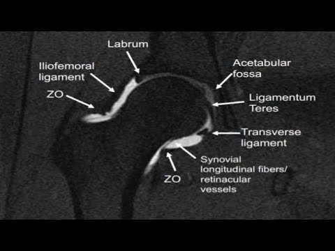 Planning and protocol of MRI PBH and MRI Rt Hip