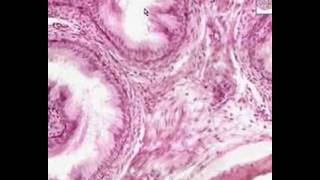 Shotgun Histology Epididymis