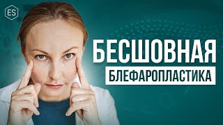 👁 БЕСШОВНАЯ БЛЕФАРОПЛАСТИКА. Чем ОПАСНА трансконъюктивальная блефаропластика? - Елена Сухопарова