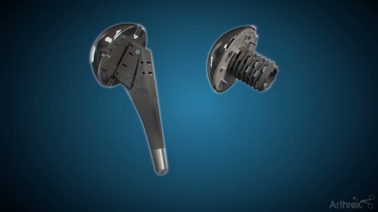 Anatomic Total Shoulder Replacement With the Eclipse™ Total Shoulder System