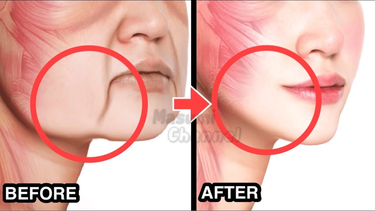 9-минутное омолаживающее упражнение для лица от обвисших уголков губ и морщин-марионеток