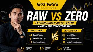 Perbedaan Akun Raw Spread dan Zero Exness | Kupas Tuntas Kelebihan & Kekurangan