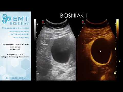 Ультразвуковая диагностика кист почек по Bosniak