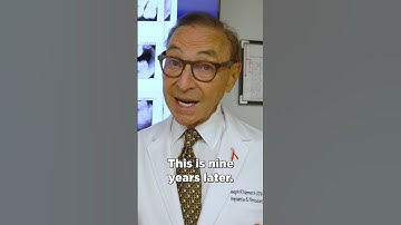 This Patient Waited 9 YEARS And Lost 95% of His Bone! “It Was Too Late”