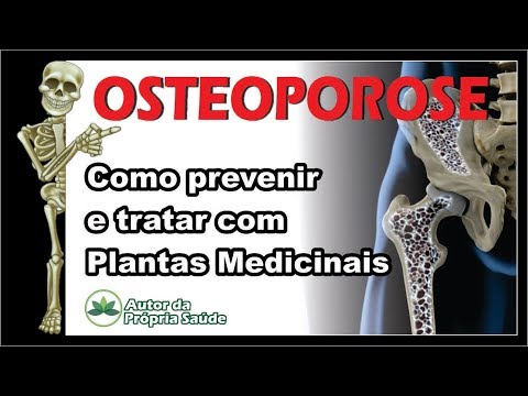 Como tratar Osteoporose de maneira natural - 28/05 - Transmissão ao Vivo. - Como tratar Osteoporose de maneira natural - 28/05 - Transmissão ao Vivo.