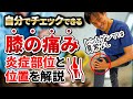 膝の痛みが出る場所を自分でチェックできる解説です！レントゲンではうつらない痛みの原因と部位を確認しましょう！