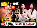 How Acne Starts? 😳 Dermatologist Reveals the Truth | Dr. Annapurna with Actress Laya Gorti