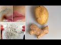 permanent body hair removal with potato in 1 day  (100 % effective)