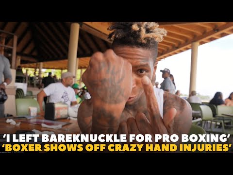 ‘bone Breaks, Cuts, Muscle Damage & More’ Howard Davis Leaves Explains Move To Pro Boxing | Bkfc