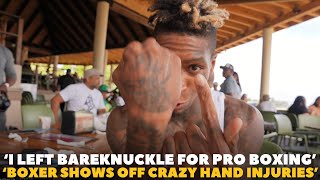 ‘bone Breaks, Cuts, Muscle Damage & More’ Howard Davis Leaves Explains Move To Pro Boxing | Bkfc
