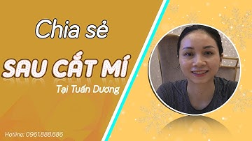 Trầm trồ với hình ảnh cắt mí mắt sau 1 tháng | Bác Sỹ Tuấn Dương