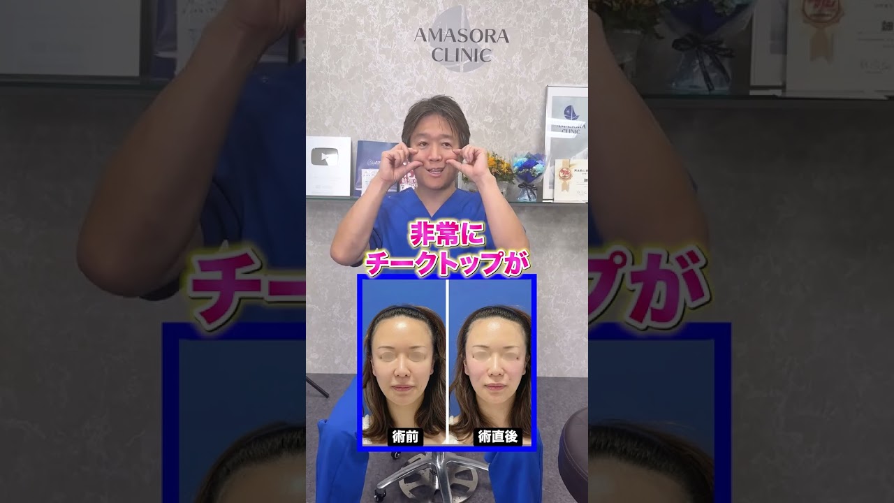 ほうれい線吊り上げで10歳若返り! #shorts