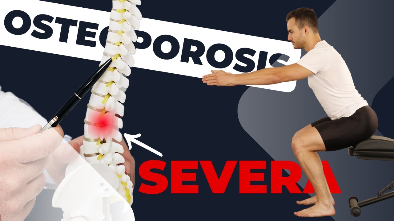 EJERCICIOS seguros para COLUMNA con OSTEOPOROSIS severa