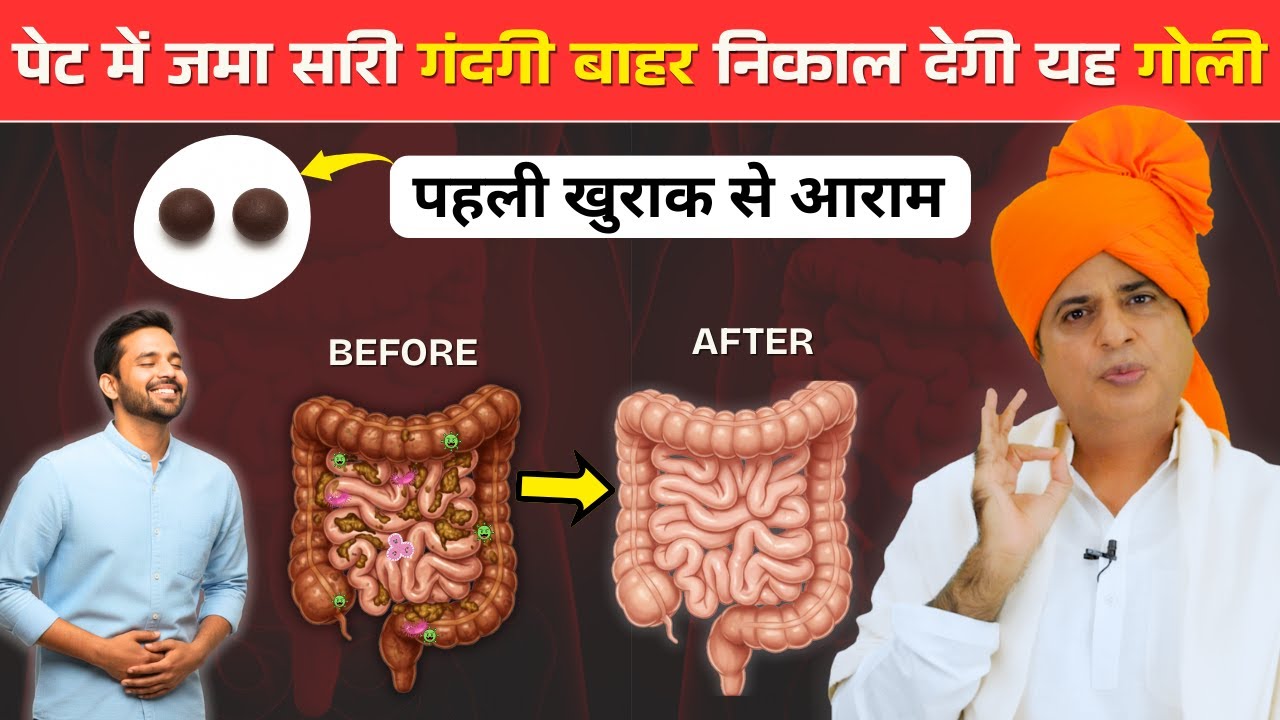 पेट और आंतों में जमा सारी गंदगी बाहर निकाल देगी यह गोली, घर पर आसानी से बनाएं || Sanyasi Ayurveda ||