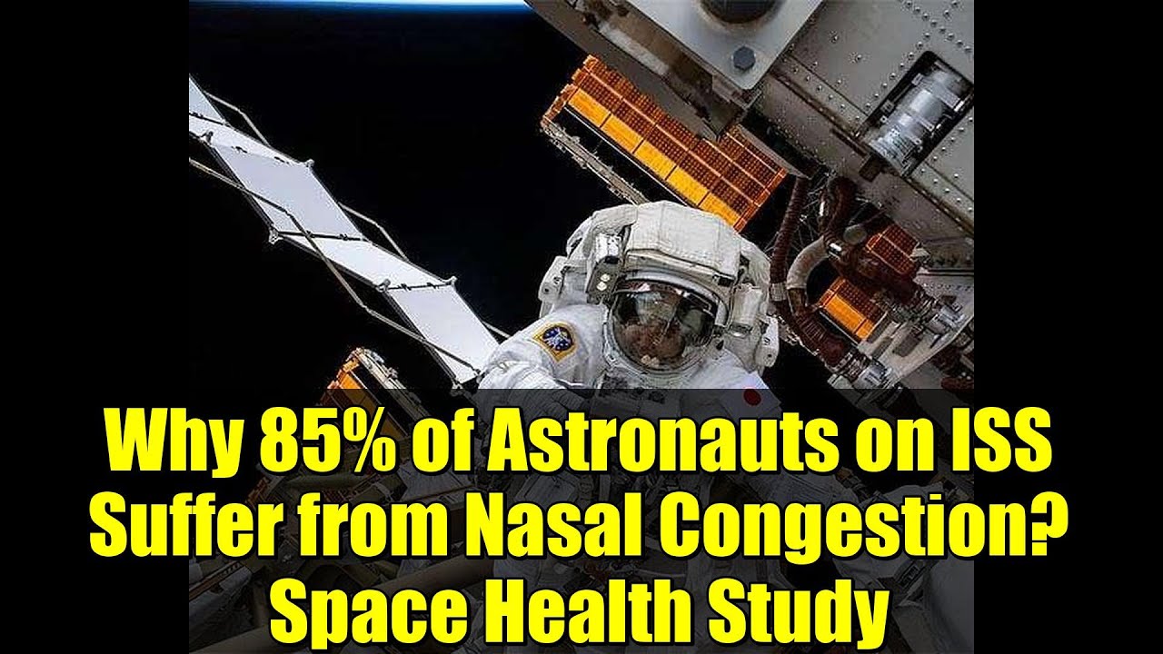 Why 85% of Astronauts on ISS Suffer from Nasal Congestion? Space Health Study