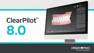 ClearCorrect | NEW ClearPilot 8.0 - March 2024