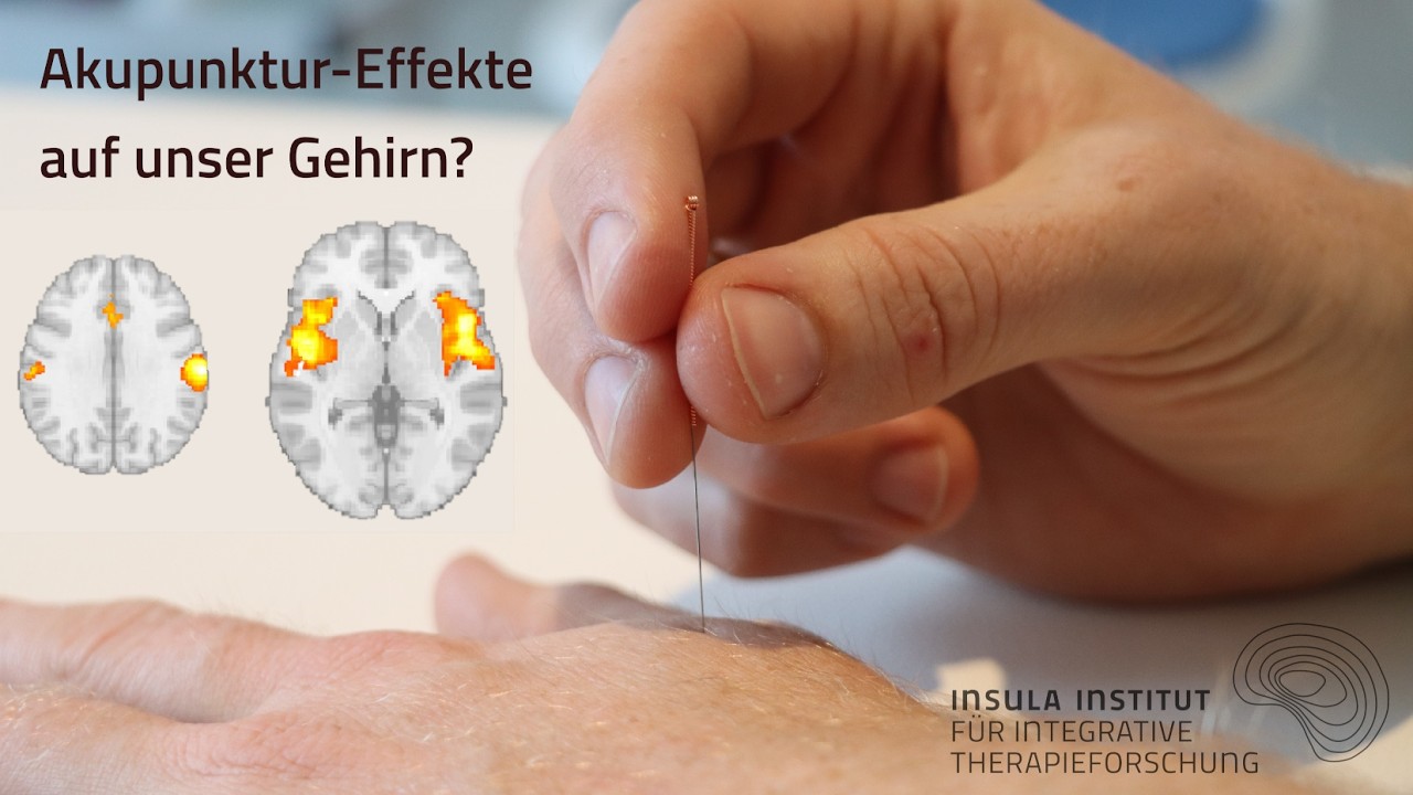 Wie wirkt Akupunktur? Neurowissenschaftliche Perspektiven | Prof. Dr. Florian Beißner