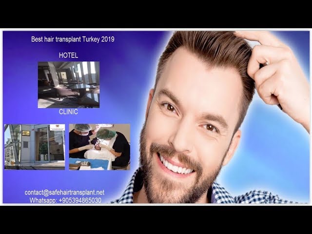 Best hair transplant Turkey 2019