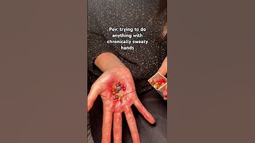 Don’t get me started on fingerprints 😭 #hyperhidrosis #excessivesweating #hyperhidrosischeck #sweat