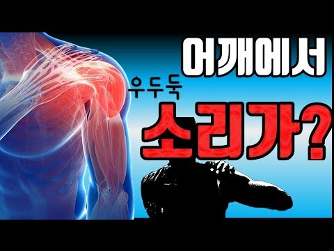 손목건초염