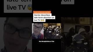 ⚠️What does a late-term abortion actually involve? This doctor explains⚠️