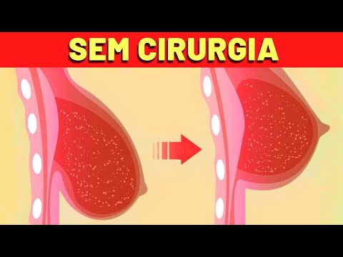 LEVANTAR OS SEIOS SEM CIRURGIA? Veja ISSO!