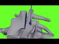 spin disk treatment skeleton medical animation