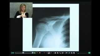 Super Deposition -- Sample 2