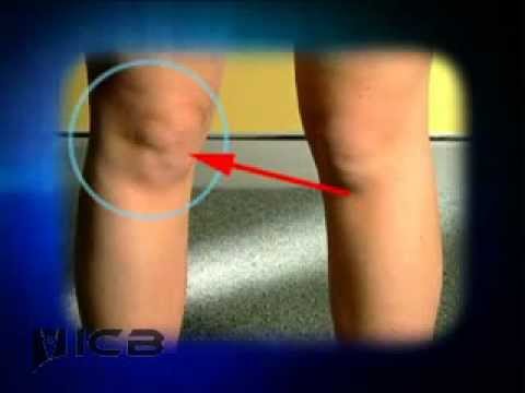 Inside And Outside Knee Pain Youtube