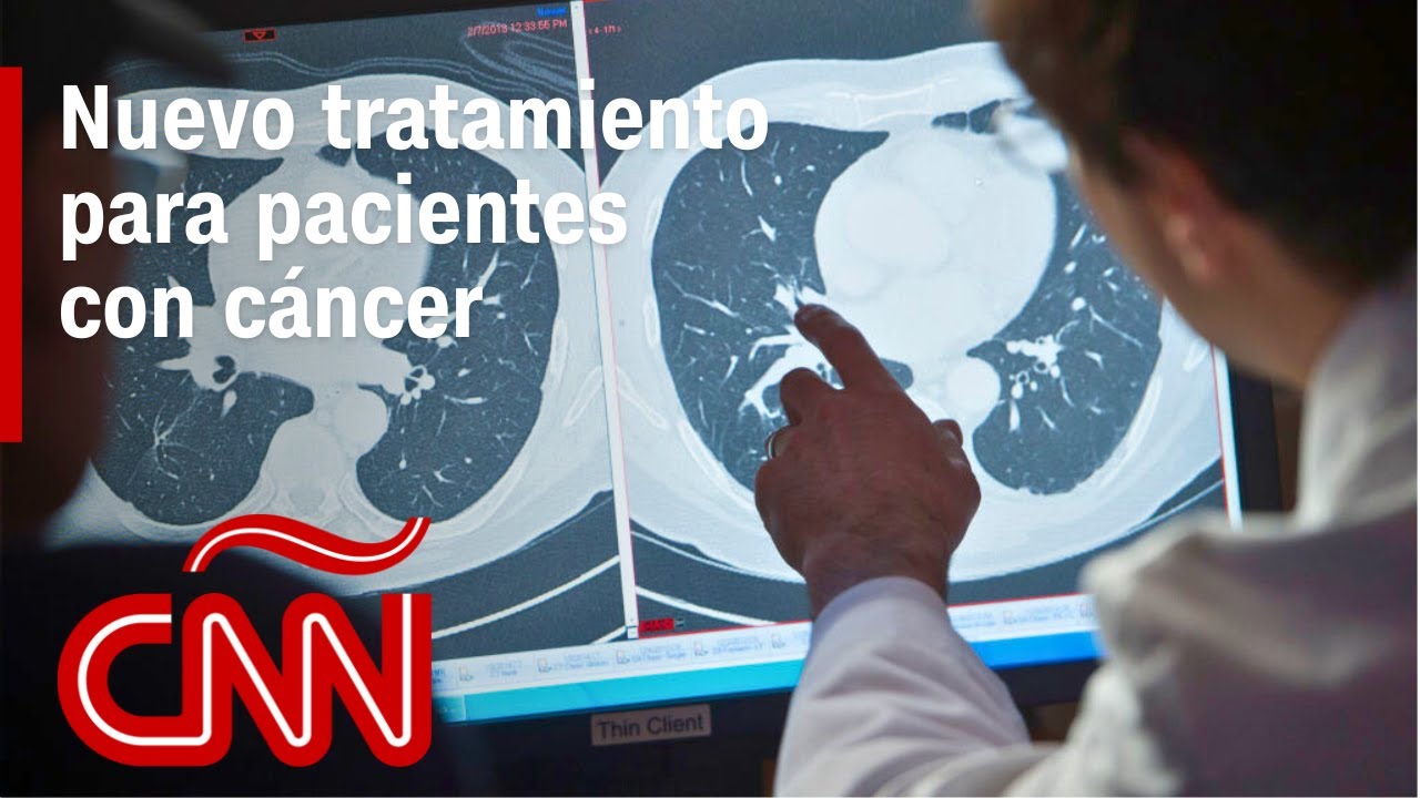 Inmunoterapia, una nueva esperanza en la lucha contra el cáncer